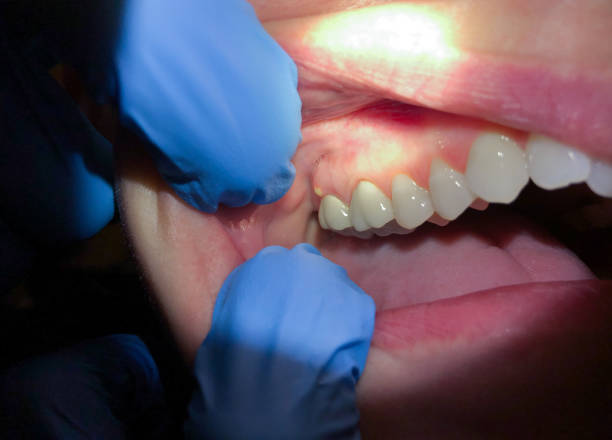  Parkville, MO Emergency Dentist Pros
