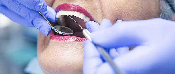 Best Emergency Denture Repair in Parkville, MO